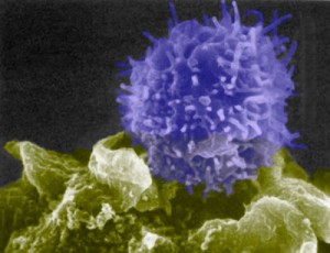dendritic cells